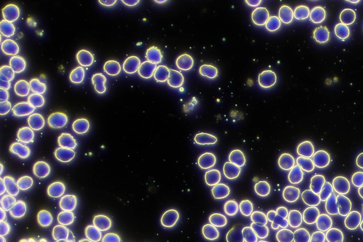 Rote Blutkörperchen unter dem Dunkelfeldmikroskop